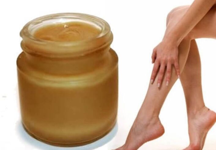 Honey for varicose veins