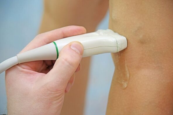 Ultrasound vein