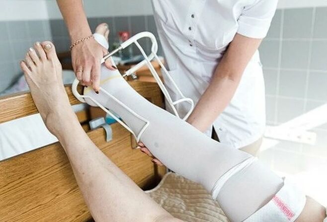 Postoperative period from the surgery on the veins of the legs
