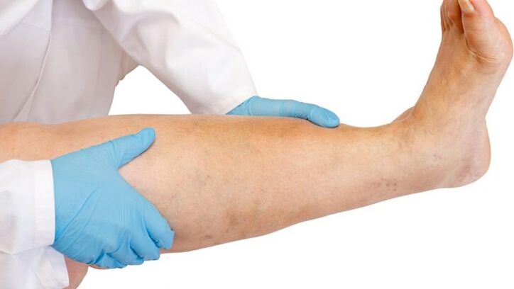 how to recognize the disease